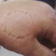Where doctor aboesh bit me for some fking reason ?? I asked if I could try lexapro?