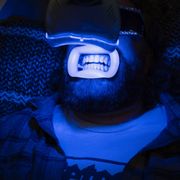 Teeth whitening