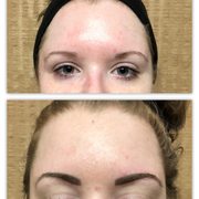 Before & Immediately After Eyebrow Enhancement