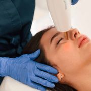 Laser Skin Treatments for sun & age spots, wrinkles, vein treatment, scarring, and more