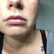 After 2nd appointment