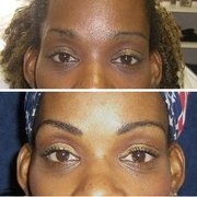 Before & After Eyebrow Enhancement