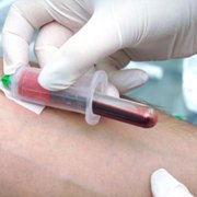 Lab work and Mobile Phlebotomy
