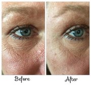 Neora Eye Serum