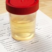 Urine Drug Testing Personal - Court - Company - DOT