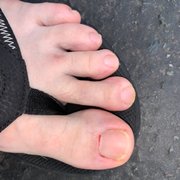 Hurts