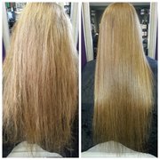 Treatment B4 and After