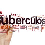 TB - Testing