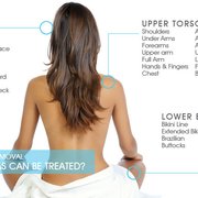 Laser Hair removal for all skin types!