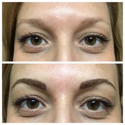 Eyebrow Enhancement