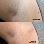underarm wax