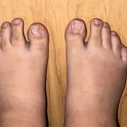 How I left after they only removed polish