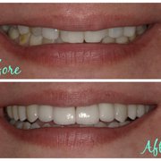 Dr Gary Walker's beautiful Before and Afters.