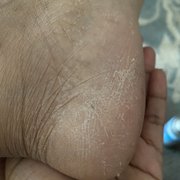 This is soon as I got home I still need a pedicure one of the main parts of a pedicure is the foot scrubbing