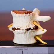 Gallery image #3