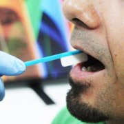 DNA testing