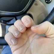 You can see the uneven gel and damage to cuticles.