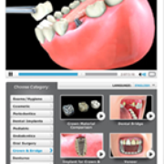 brushing flossing and teeth whitening chico ca dentist