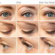 Semi-permanent eyelash extensions