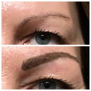 Before & Immediately After- This brow will heal to a soft, feathery natural looking brow!