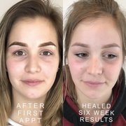 Combo Brow Microblading
