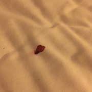 Bed bugs