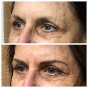 Before & Immediately After Eyebrow Enhancement